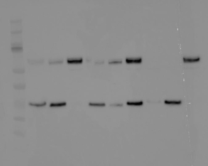 /ARSUserFiles/58151/western blot 2.jpg